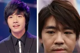 从美男子到毁容，再到浴火重生的俞灏明，到底经历了什么？图片