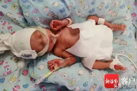 巨额医疗费无着落，海口三胞胎早产儿盼救助图片