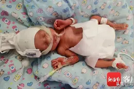 巨额医疗费无着落，海口三胞胎早产儿盼救助图片