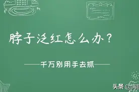 脖子泛红怎么破图片