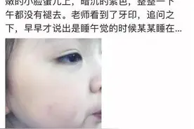著名主持人王小骞女儿学校挨欺负被同学咬脸，妈妈做法获网友狂赞图片