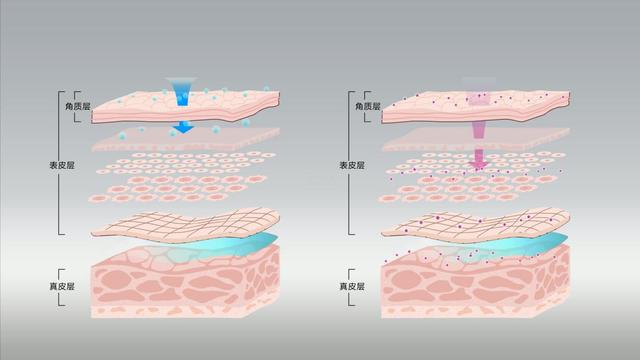 沃纳综合症，生化检查需分析患者血脂，以及尿肌酐，氨基酸的情况