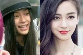 “水光针”是什么，为什么深受娱乐圈女星宠爱？图片