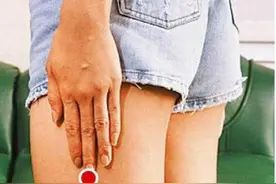 最好找的祛湿养生穴，你自然站立双手下垂，中指间指的地方就是图片