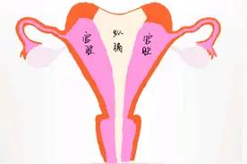 成双成对未必是好事 少女双宫颈双阴道腹痛难耐图片