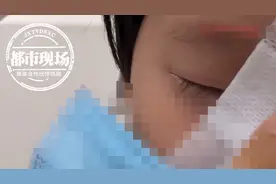 想想都疼！3岁女童不慎摔倒，筷子戳进鼻子断成两截图片