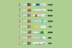 平价祛痘｜我用三年经验告诉你哪款祛痘膏最好用图片