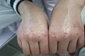 小姐姐，你的手还疼吗？图片