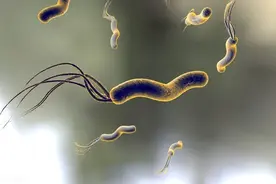 胃癌的“导火索”？让超过80%的胃病患者惧怕，它为何难以根治？图片