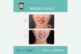 厦门牙齿矫正：隐适美牙套为什么那么贵？图片