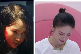 植发太贵假发片硌头？想要增发量+隐藏发际线，不如和杨幂学几招图片