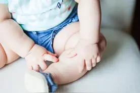 防治痱子，液体爽身粉“桃子水”有用吗？图片