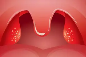 孩子扁桃体发炎应当如何处理？大多数孩子的家长都是这样做的图片