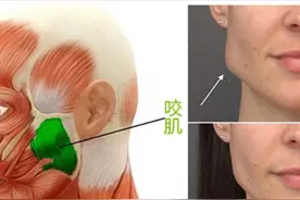 我打瘦脸针“差不多有10年”了，分享真实经验图片