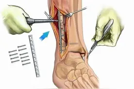 取出来的钢板去哪了？我想带走纪念……图片