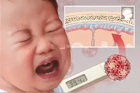 孩子高烧40℃，会不会烧坏脑子?图片