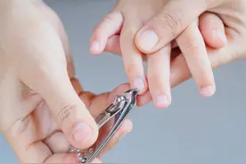 手上倒刺一直撕一直长，到底孩子缺了哪种元素？图片