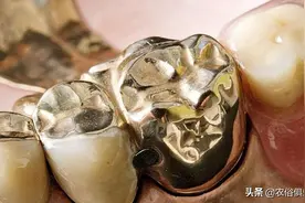 农村不让带金属下葬，老一辈选择火葬或土葬，镶的金牙怎么处理？图片