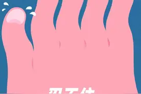 原来那么多人有「强迫性皮肤剥离症」？图片