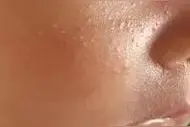 新生儿护理疹子篇图片