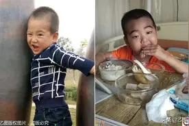 4岁男童生病后相貌大变，哥哥来探望他被吓哭：这不是我弟弟图片