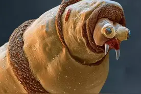 令人震撼的人体显微世界图片