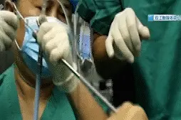 5岁男孩气管内发现活蚂蟥，已存活一年多！医生提醒：别再这样喝水图片