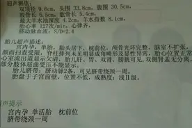 什么是双顶径？用双顶径预估胎儿的体重准确吗？这些影响孕妇须知图片