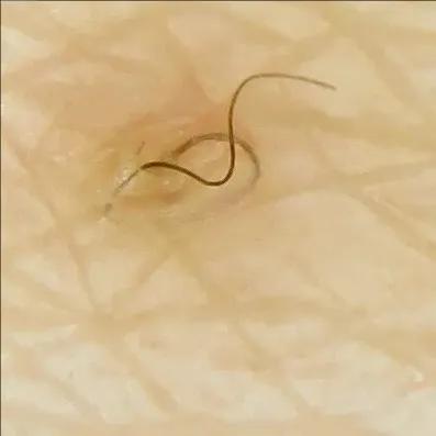 野脚鸡皮肤穿裙子 野脚鸡皮肤穿裙子