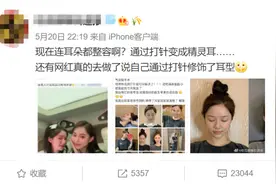 网红流行的”精灵耳”是什么？教你0成本拥有精灵耳图片