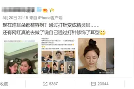 网红流行的”精灵耳”是什么？教你0成本拥有精灵耳图片