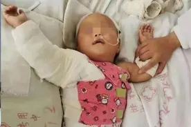 揪心！呼和浩特一女婴掉入开水锅中，烫伤严重图片