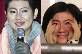 “苦命女神”任家萱，严重烧伤遭嫌弃，对前任下跪，父母后悔生她图片