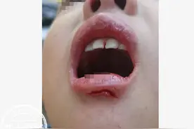 商务车当校车！4岁女童流血不止，园长：漂亮女孩脸上多少会留点疤图片