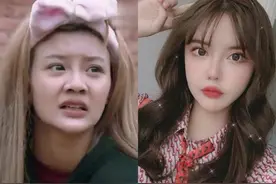 安冉因为整容宣布退网，但转身就开起了直播，脸上全是“针线”图片