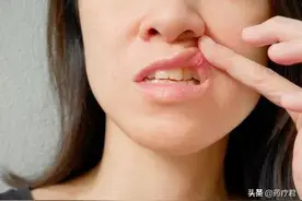 还在为口腔溃疡而烦恼？这里教你几个小妙招，快速止痛图片