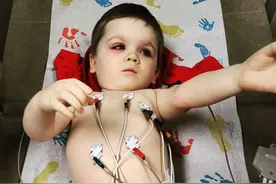 蠢萌蠢萌的洗澡鸭，差点让我儿子失去了一只眼图片