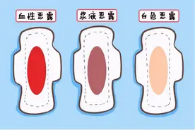 生产后的烦心事：恶露啥时走月经啥时来？图片