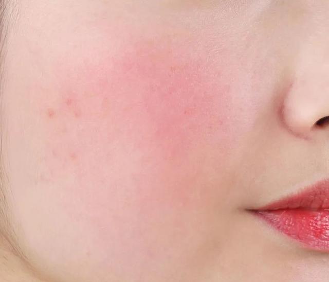 涂完芦荟胶还可以涂身体乳吗