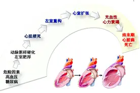 心室肥厚、心脏扩大、心力衰竭，高血压下的心脏都经历了什么？图片