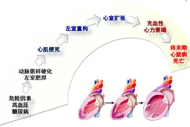 心室肥厚、心脏扩大、心力衰竭，高血压下的心脏都经历了什么？图片