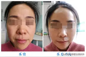 51岁左右想变年轻？可以参考一下我的经历图片