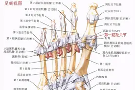 第一跖趾关节扭伤后的康复方案图片