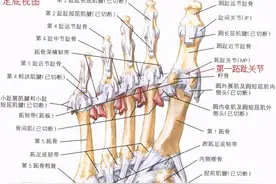 第一跖趾关节扭伤后的康复方案图片