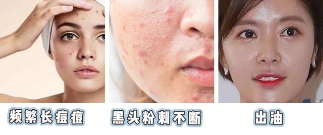 涓嶅埌鐧惧厓鐨勬皑鍩洪吀娲楅潰濂讹紝鑷甫娲侀潰鍒峰ご锛岀毊鑲よ秺娲楄秺婊戞簻