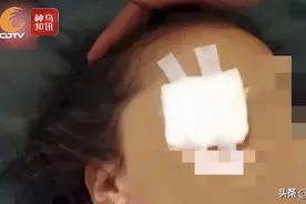 骇人听闻！信奉“黑魔法”，印尼6岁女孩的家人竟徒手挖出她的眼睛“献祭”……图片