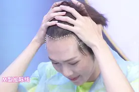 5大常见脱发类型，你属于哪一种呢？视频封面