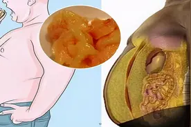 想要干掉脂肪，首先要了解脂肪图片