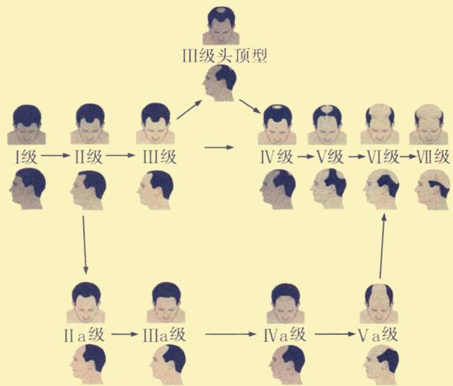 汗孔角化斑能不能发生癌变