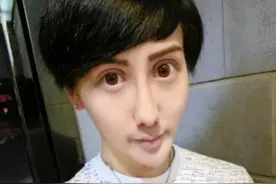 “蛇精男”刘梓晨毁容后又感染新冠，发文哭诉：太难过了我好无助图片